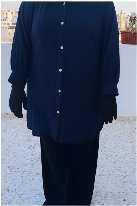 بعد العملية