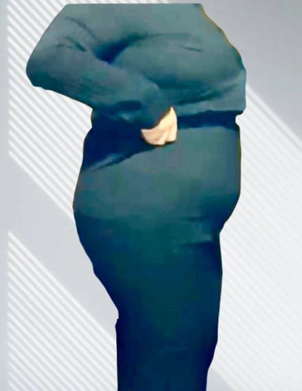 قبل العملية