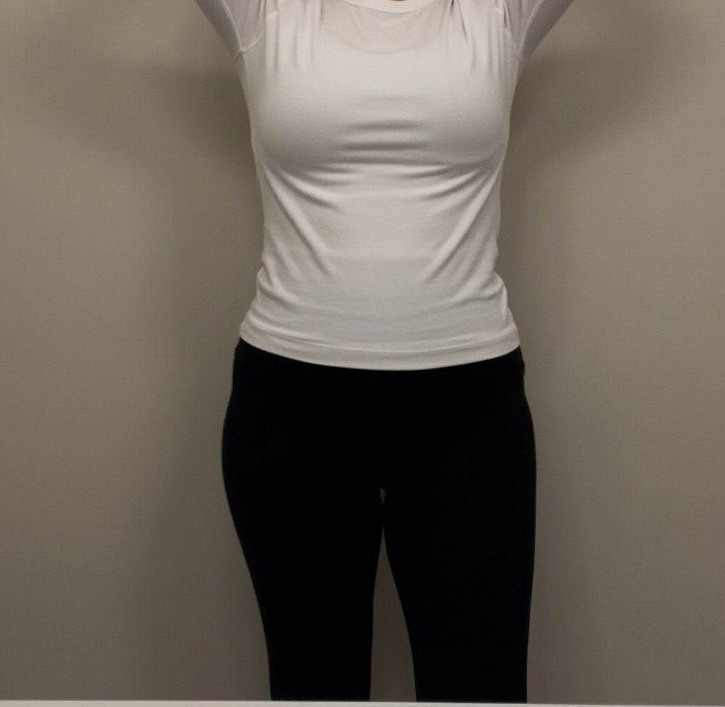 بعد العملية